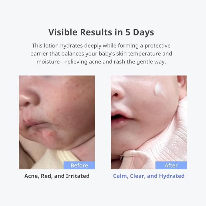 CHA&MOM Korean Baby Skincare - Hypoallergenic, Plant Based, and Natural Phyto Seline Moisture Lotion, 8.46oz
