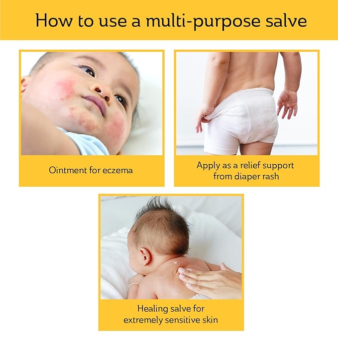 Mickelberry Gardens Herbal Baby Salve – Organic Diaper Rash Cream with Calendula & Beeswax – Natural Soothing Ointment for Sensitive Skin, Eczema & Dryness (1 oz)